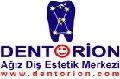 Dentorion A��z Di� Estetik Merkezi